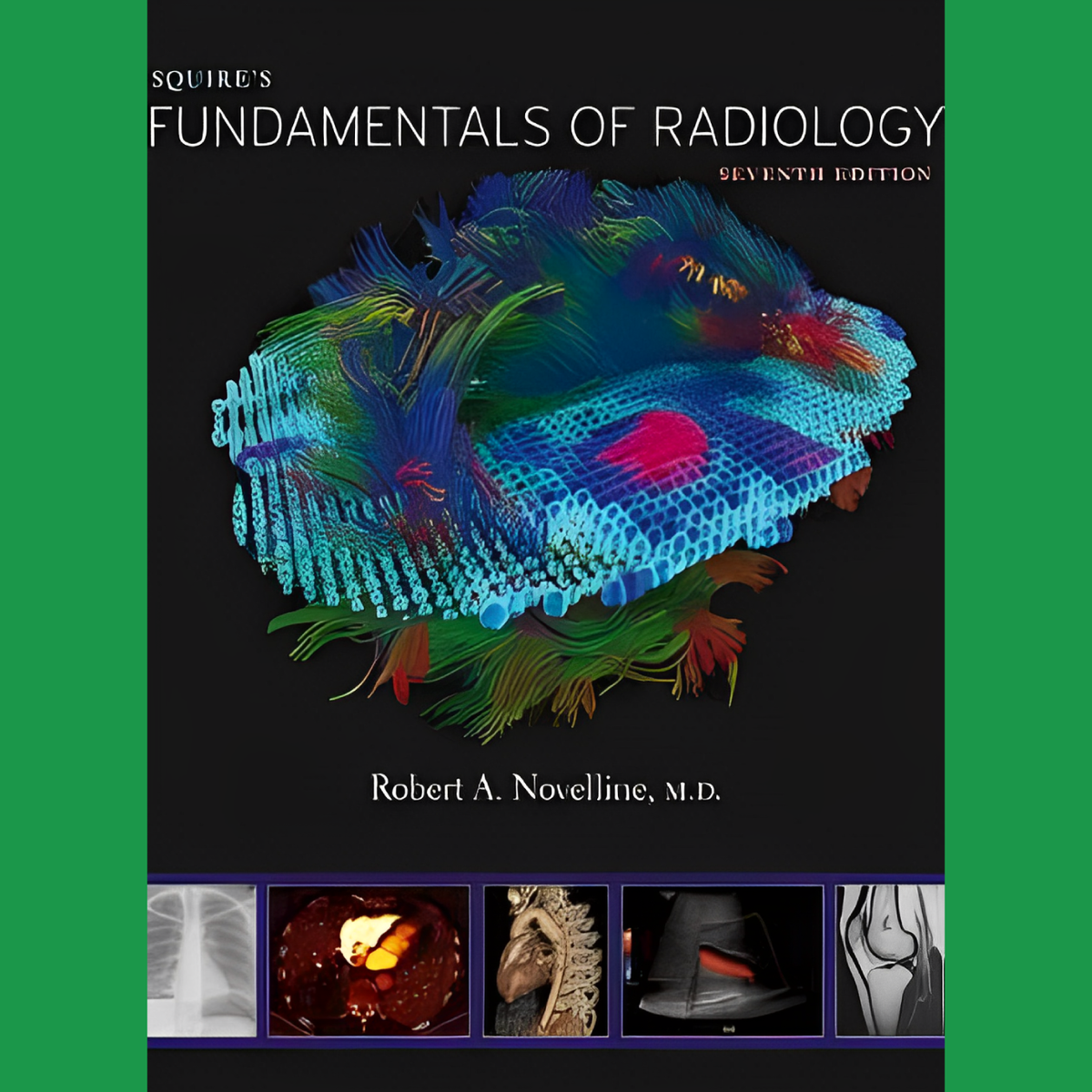 3e Bachelor: Squire's Fundamentals of Radiology - R. A. Novelline
